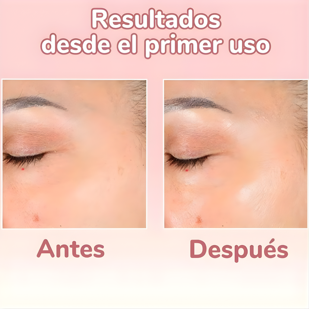 Serum 4 en 1 Antiarrugas y Manchas