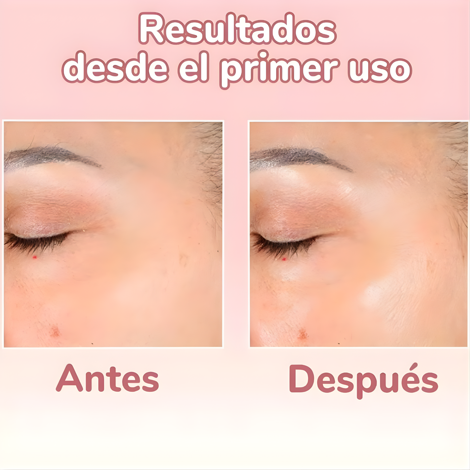 Serum 4 en 1 Antiarrugas y Manchas