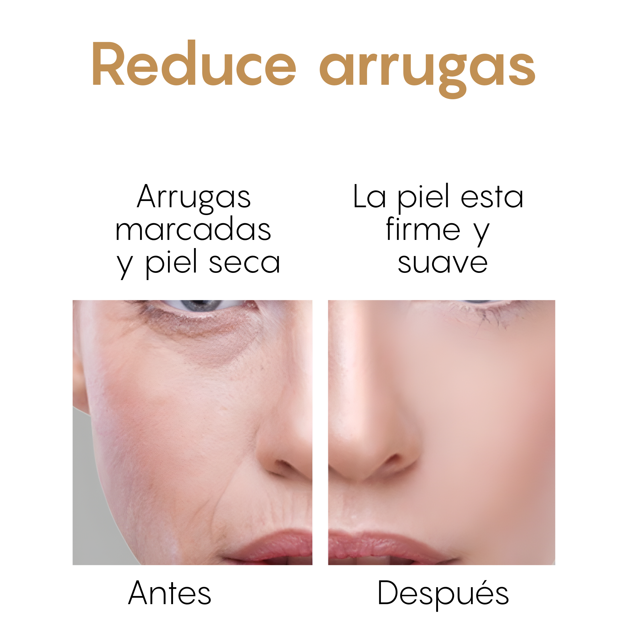 Serum Colageno Reafirmante Arrugas Goter